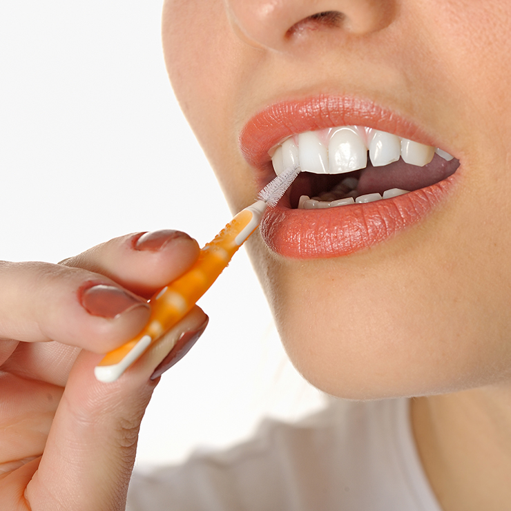 What are interdental toothbrushes?