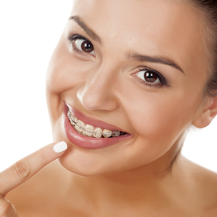 Šta je ortodontska terapija?