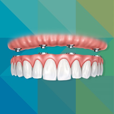 Ko je kandidat za ALLON4?