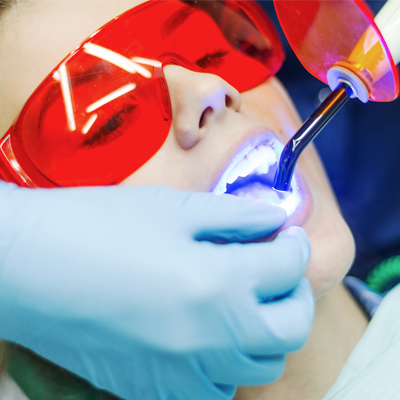 Od čega su napravljene plombe?