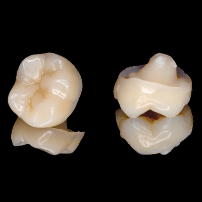 Šta su to endokrune