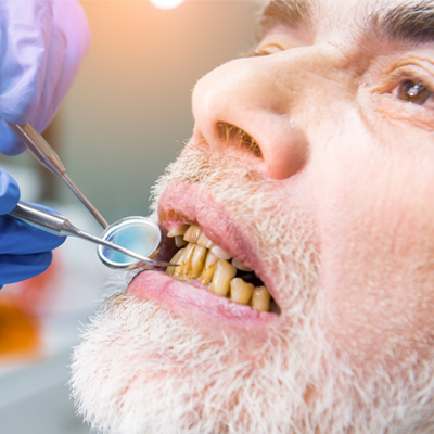 Duvan i oralno zdravlje