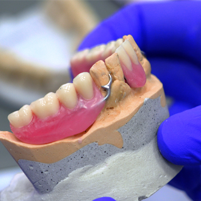 Mostovi i krunice vs proteze